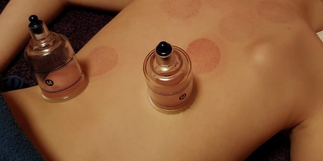 Thai Cupping Massage Therapy and Training in Thailand