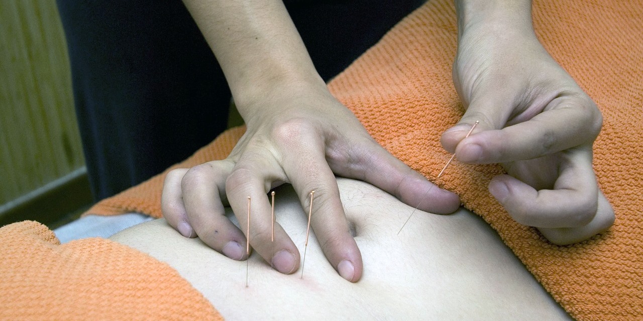 Acupuncture | Traditional Chinese Medicine