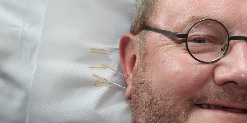 Man receiving acupuncture in ears