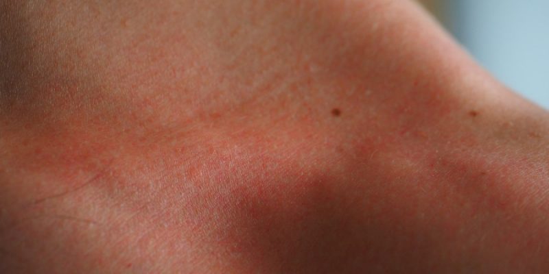 Thai Massage Therapy, Energy Release and Detoxification