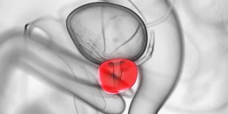Prostate Massage Treatments in Cape Town – South Africa