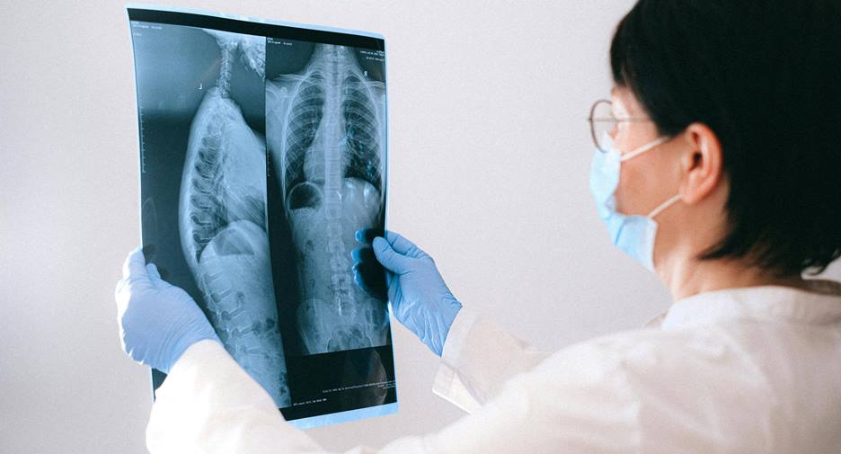 Doctor checking x-ray of spine
