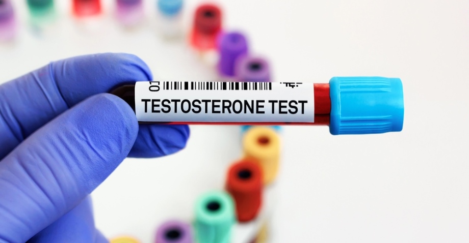 Laboratory test for low testosterone