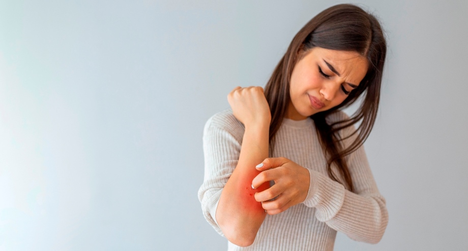 Woman scratching her skin
