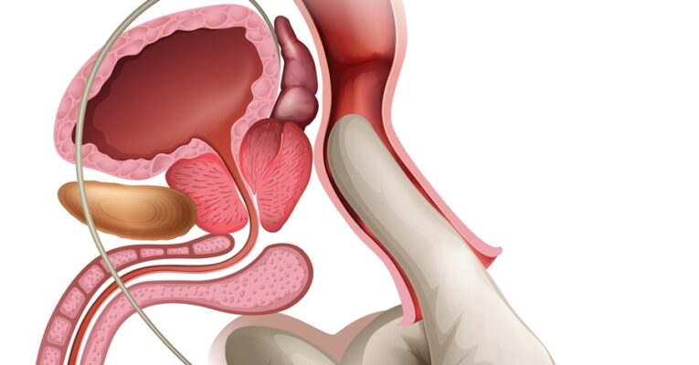 Prostate Massage – Precautions and Contraindications